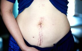 Supplements for post surgery recovery in dogs