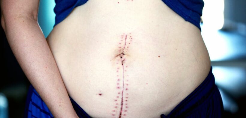 Supplements for post surgery recovery in dogs