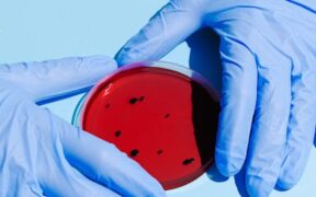 When to bring a stool sample for parasite testing in cats