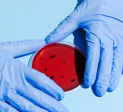 When to bring a stool sample for parasite testing in cats