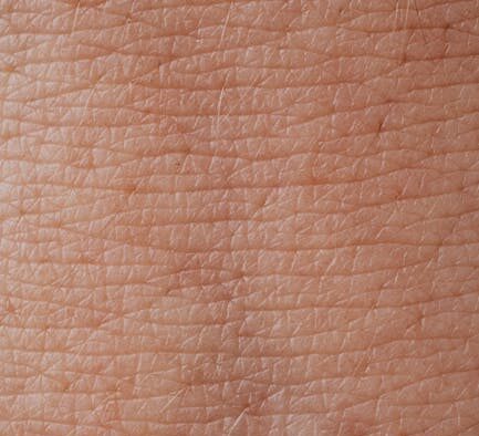 Cat rough skin texture signs and possible reasons