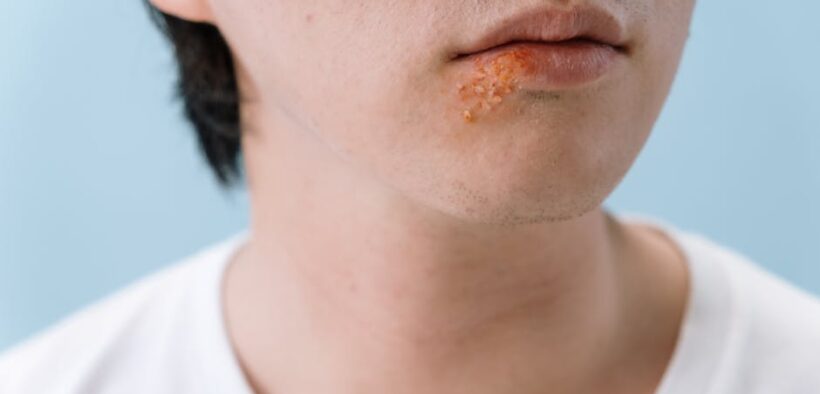 Cat skin infection reasons symptoms and vet care