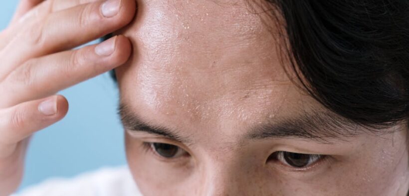 Humidity related anxiety in pets