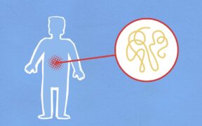 Burping in dogs frequent belching digestive symptom