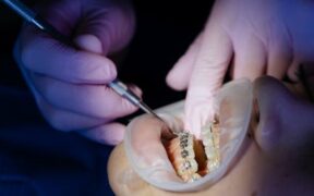 Pet Dental Care During Adjustment Period