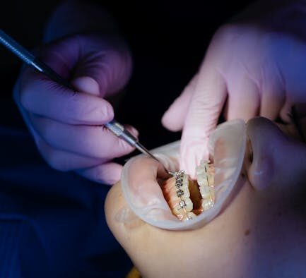 Pet Dental Care During Adjustment Period