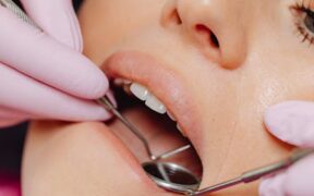 Daily mouth care practices for dogs prevention tips