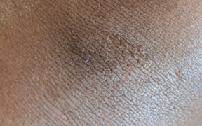 Dog rough skin texture symptoms and general causes