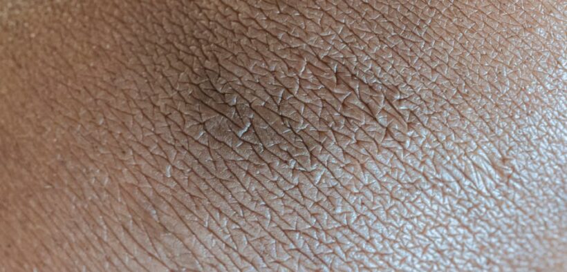 Dog skin cracking dry areas symptoms and possible reasons