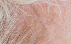 Supplements for healthy skin in short haired dogs