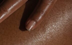 Preventive strategies for cats with sensitive skin