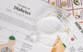 Senior cat nutrition basics and how to maintain body condition