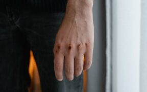 Cat skin ulcer open wound symptoms and what to know