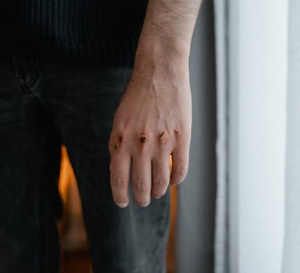 Cat skin ulcer open wound symptoms and what to know