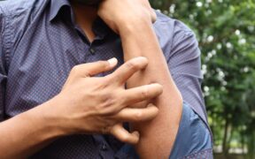 Can my cat have skin problems without itching