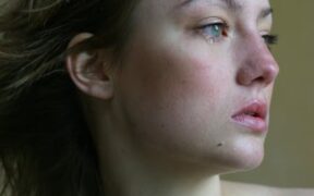 Can stress trigger skin flare ups in cats