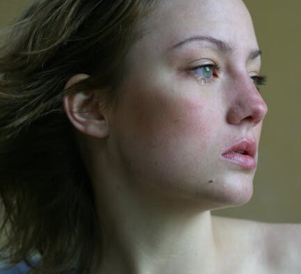 Can stress trigger skin flare ups in dogs