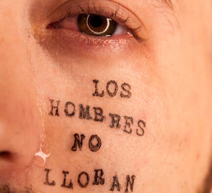 Why pain is not always obvious in pets