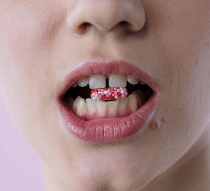 Can skin infections heal without treatment