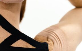 Can my cat have skin inflammation from arthritis