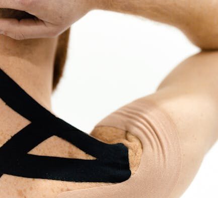 Can my cat have skin inflammation from arthritis