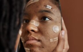 Can my cat have skin reactions to bandages