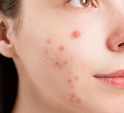 Can my cat have skin problems from hormonal changes