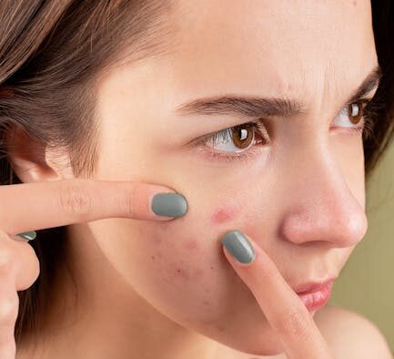 Does saliva irritate pet skin