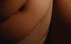 Does weight affect skin health in pets