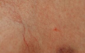 When skin swelling after injury is urgent