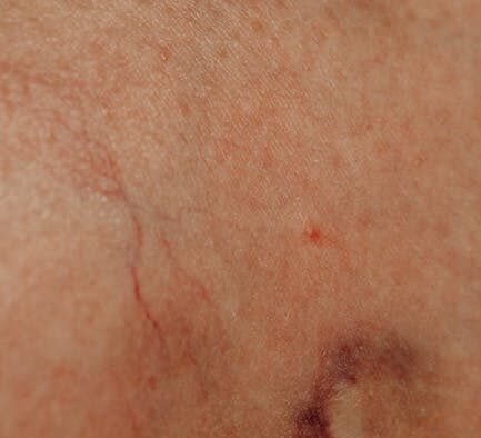 Why does my dog have skin swelling after injury