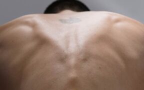 Can parasite medication cause hunched back appearance