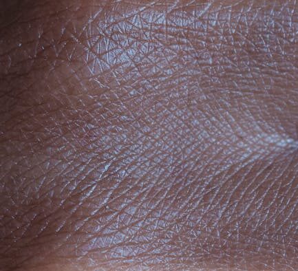 Can my cat have skin dryness from heating