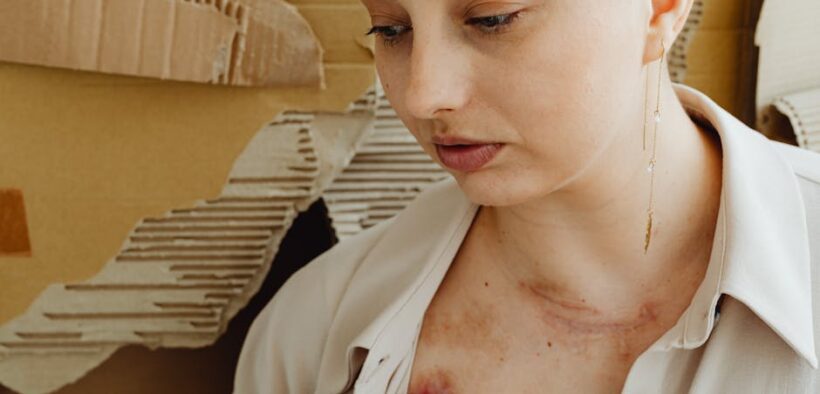 Post injury pain in pets explained