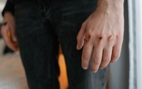 Can my cat have skin pain after scratching