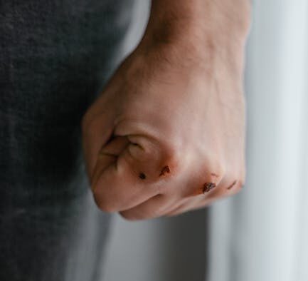 Is scar related skin change normal