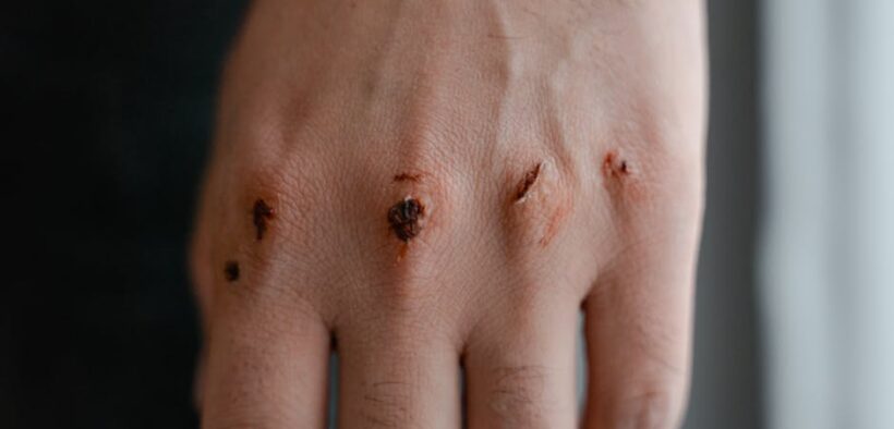 Can my dog have skin pain without wounds